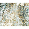 CANVAS ART J1112 MULTI / MULTI
